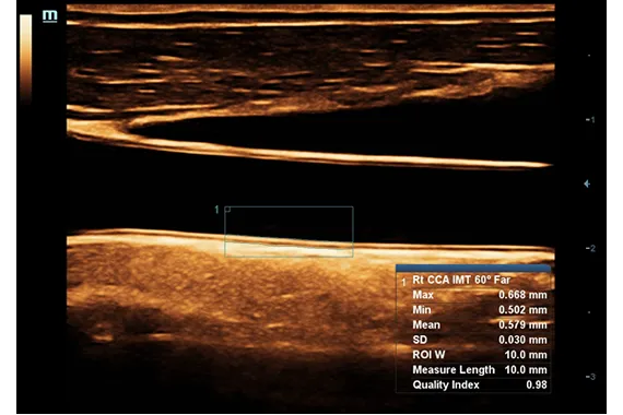 Клинические изображения УЗИ аппарат Mindray DC-45