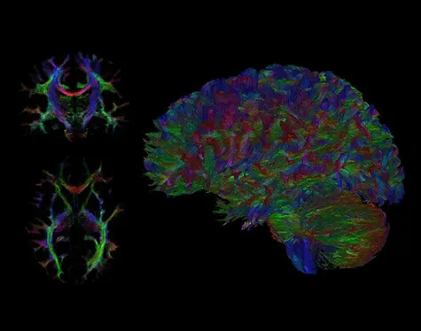 Клинические изображения МРТ аппарат GE SIGNA Premier 3T