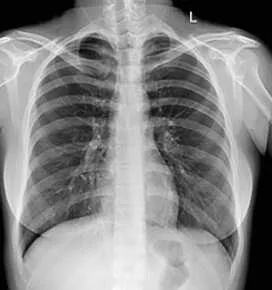 Клинические изображения Цифровой рентгеноcкопический комплекс Italray Clinodigit Оmega