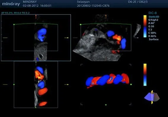 Клинические изображения УЗИ аппарат Mindray DC-8