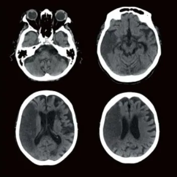 Клинические изображения Canon ASTELION 16 (32) Компьютерный томограф