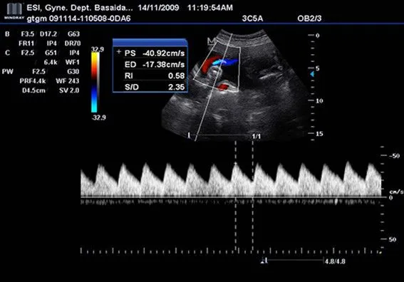 Клинические изображения УЗИ аппарат Mindray DC-T6