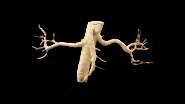 Клинические изображения МРТ аппарат SIEMENS Magnetom Amira 1.5T