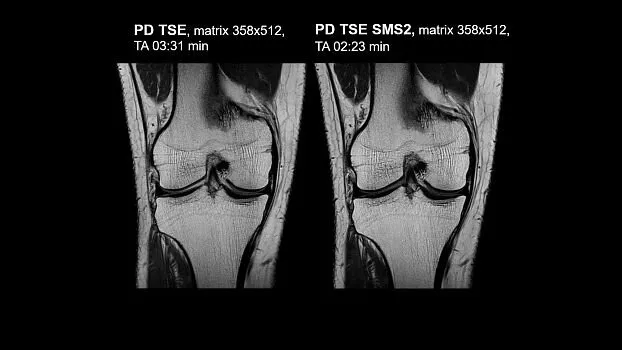Клинические изображения МРТ аппарат SIEMENS Magnetom Amira 1.5T