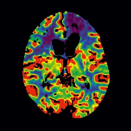 Клинические изображения Siemens SOMATOM go.All компьютерный томограф 