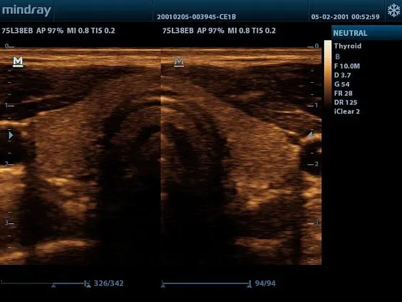 Клинические изображения УЗИ аппарат Mindray DP-20 Vet ветеринарный портативный