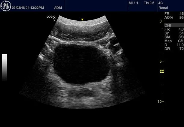 Клинические изображения УЗИ аппарат GE HealthCare Vscan Air карманный