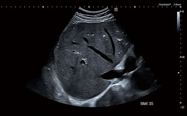 Клинические изображения Canon (Toshiba) Aplio i800 аппарат УЗИ