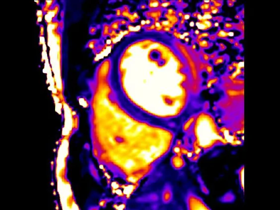 Клинические изображения Магнитно-резонансный томограф Siemens MAGNETOM Skyra 3T