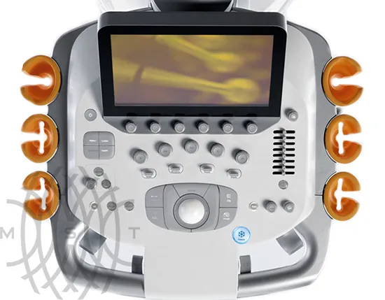 Siemens Acuson S3000 ультразвуковая система