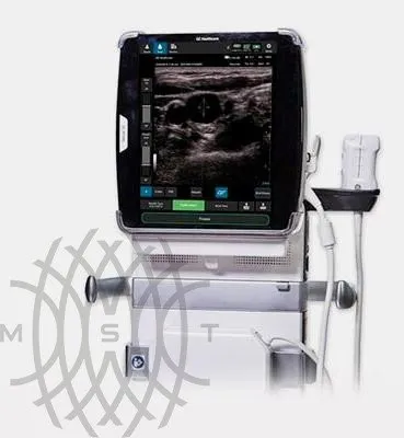 GE Venue 50 аппарат УЗИ портативный