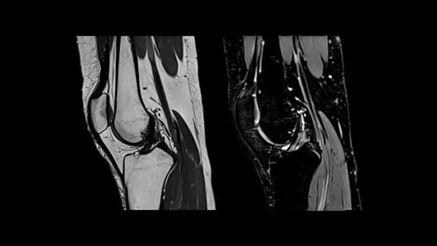 Клинические изображения МРТ аппарат SIEMENS Magnetom Amira 1.5T