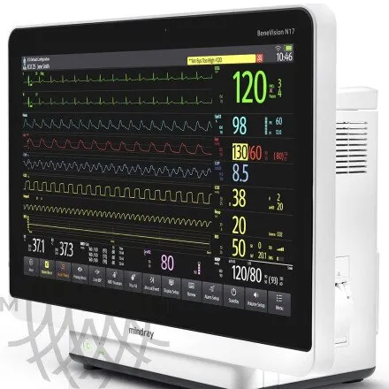 Монитор пациента Mindray BeneVision N17