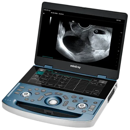 Портативный УЗИ аппарат Mindray MX8 Exp