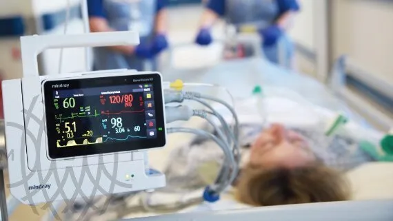 Монитор пациента Mindray BeneVision N1
