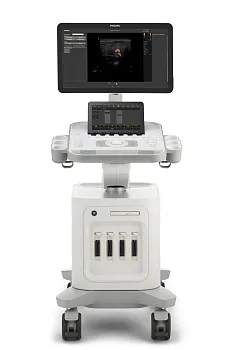 Ультразвуковой аппарат Philips 3300