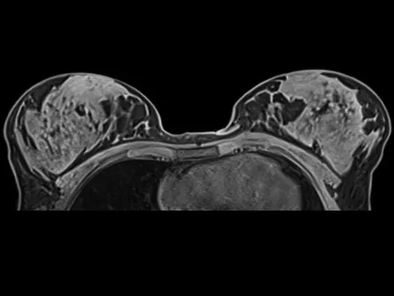 Клинические изображения Магнитно-резонансный томограф Siemens MAGNETOM Skyra 3T