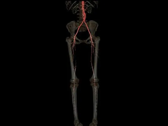 Клинические изображения GE Venue 50 аппарат УЗИ портативный