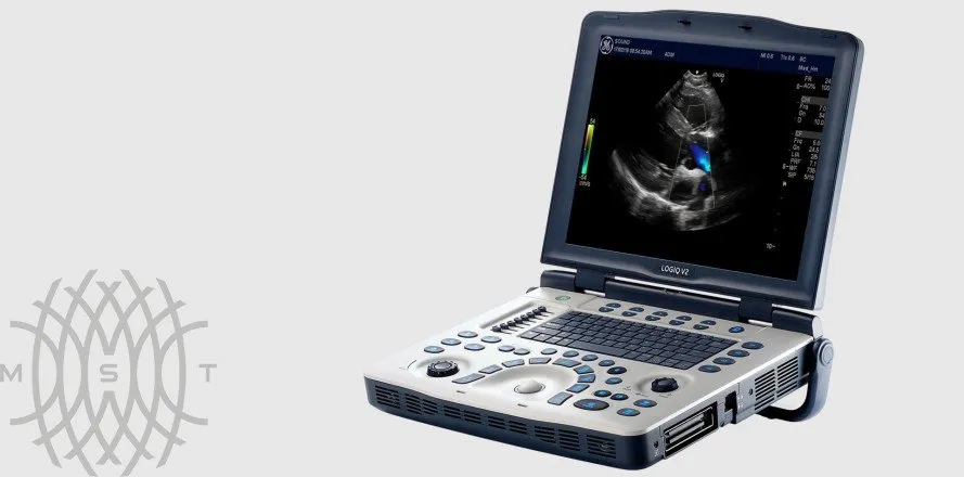 Ультразвуковая диагностическая система GE Logiq V2 УЗИ портативная