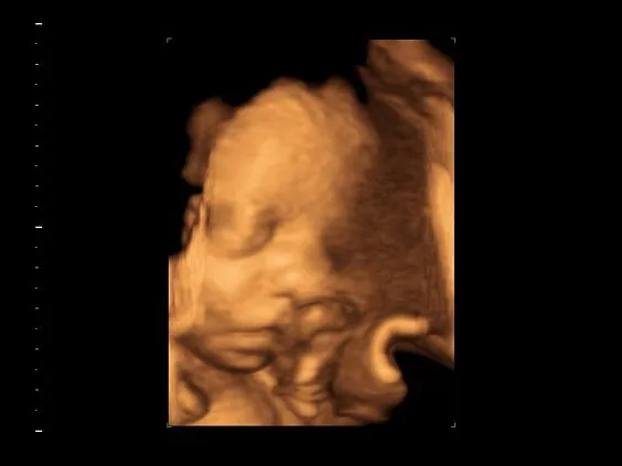 Клинические изображения Ультразвуковая диагностическая система GE Logiq S7 XDclear