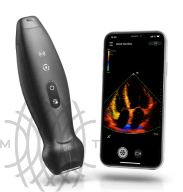 УЗИ аппарат Mindray TE Air