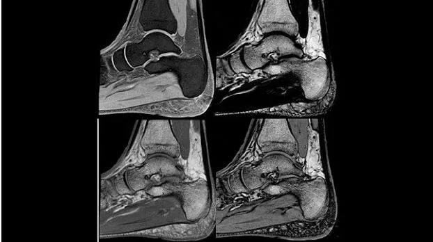 Клинические изображения МРТ аппарат GE SIGNA Explorer 1.5T