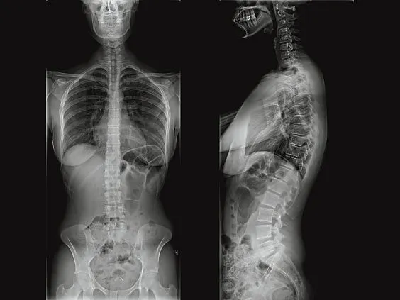 Клинические изображения МРТ аппарат GE SIGNA Voyager 1.5T