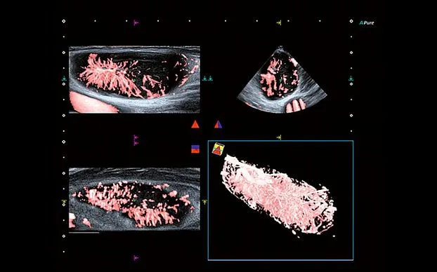 Клинические изображения Canon (Toshiba) Aplio i800 аппарат УЗИ