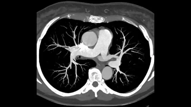 Клинические изображения Компьютерный томограф GE Revolution Maxima