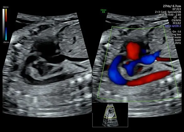 Клинические изображения Ультразвуковая диагностическая система GE HealthCare Voluson E6