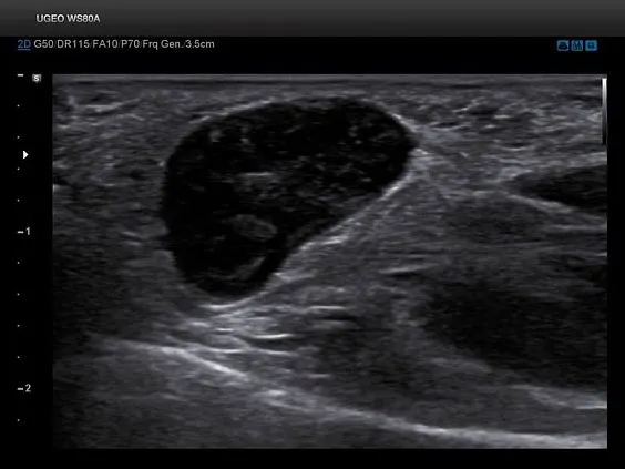 Клинические изображения Samsung Medison WS80A УЗИ аппарат