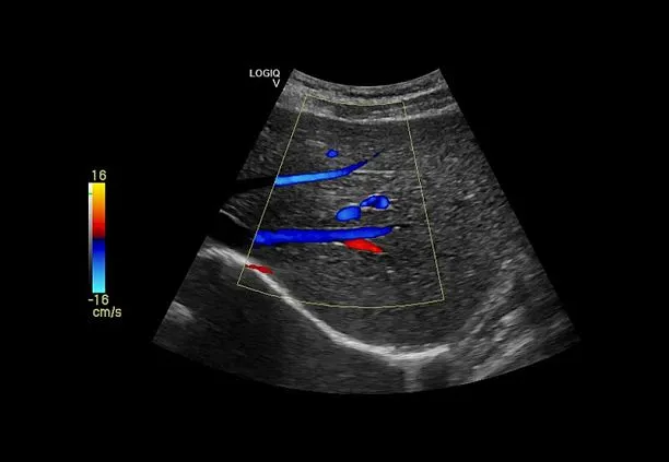 Клинические изображения УЗИ аппарат GE HealthCare Vscan Air карманный
