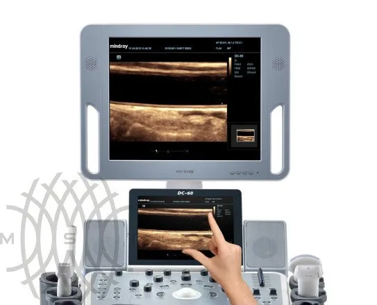 УЗИ аппарат Mindray DC-60 X-Insight