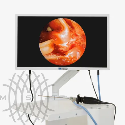 DS.Vision FHD 3in1 Видеокамера эндоскопическая с принадлежностями, вариант исполнения: F-368D  