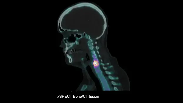 Клинические изображения Siemens Symbia Intevo Bold КТ аппарат 