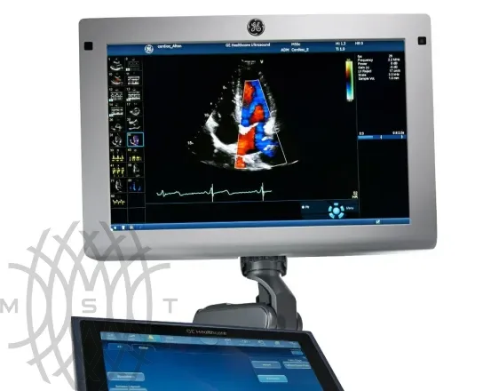 Ультразвуковая диагностическая система GE Vivid S60