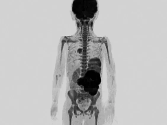 Клинические изображения Магнитно-резонансный томограф Siemens MAGNETOM Aera 1.5T