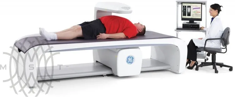 Рентгеновский денситометр GE Lunar iDXA