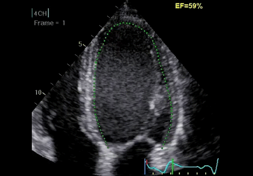 Клинические изображения УЗИ аппарат GE HealthCare Vivid E90