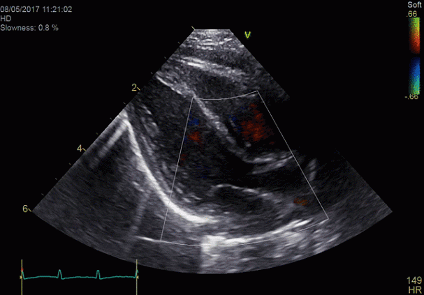 Клинические изображения Ультразвуковая диагностическая система GE HealthCare Vivid E95