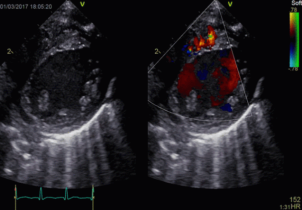 Клинические изображения УЗИ аппарат GE HealthCare Vivid E90