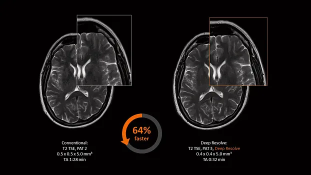 Клинические изображения МРТ аппарат Siemens Magnetom Sola 1,5T