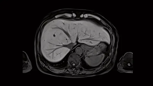 Клинические изображения МРТ аппарат Siemens Magnetom Sola 1,5T