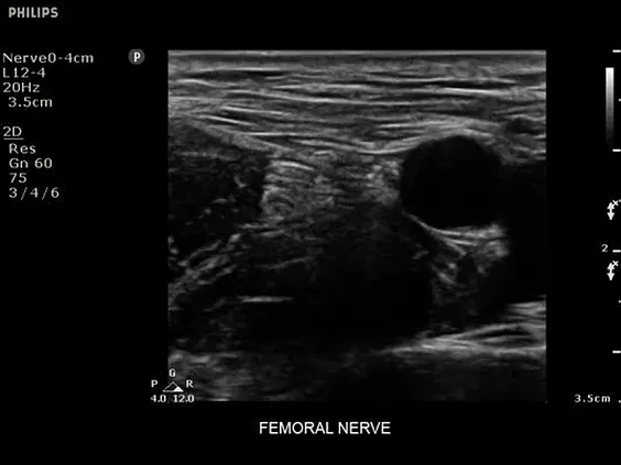 Клинические изображения Philips Sparq ультразвуковой аппарат