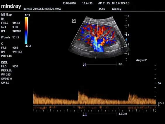 Клинические изображения Mindray M5 New Premium