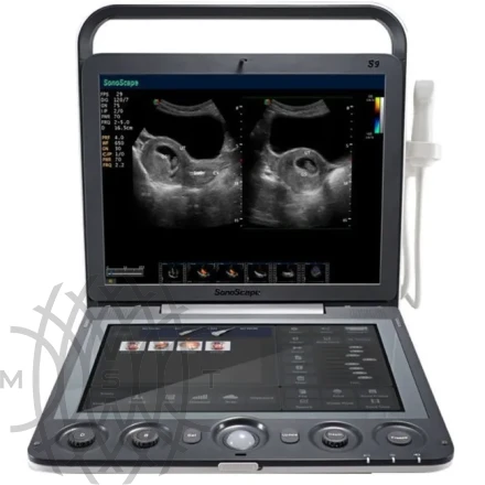 Sonoscape S9 ультразвуковой аппарат