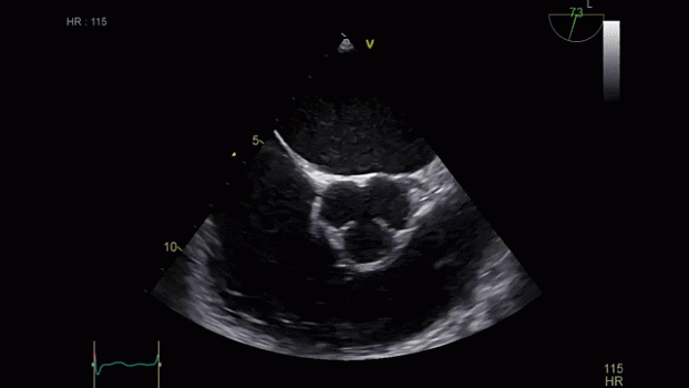 Клинические изображения Ультразвуковая диагностическая система GE HealthCare Vivid iQ портативная