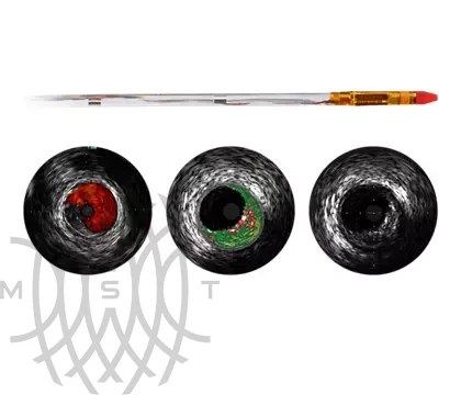 Philips Eagle Eye Platinum ST катетер ротационный