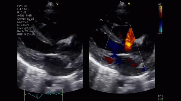 Клинические изображения Ультразвуковая диагностическая система GE HealthCare Vivid iQ портативная