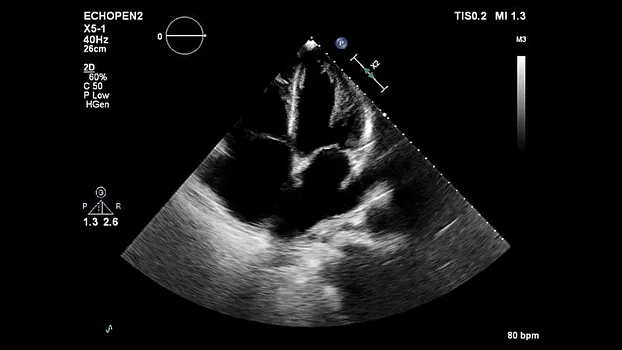Клинические изображения Philips EPIQ 7 ультразвуковой аппарат